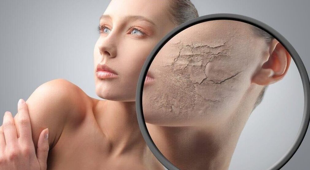 Destroy skin
