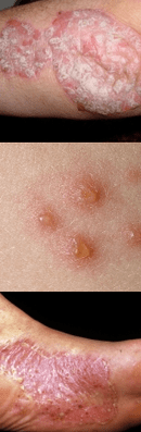 Red spots on the body